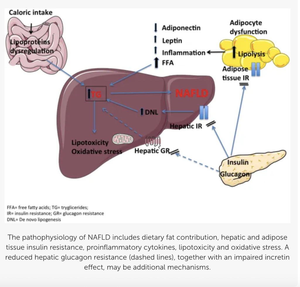 nafld pathophysiology diagram